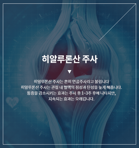 히알루론산 주사